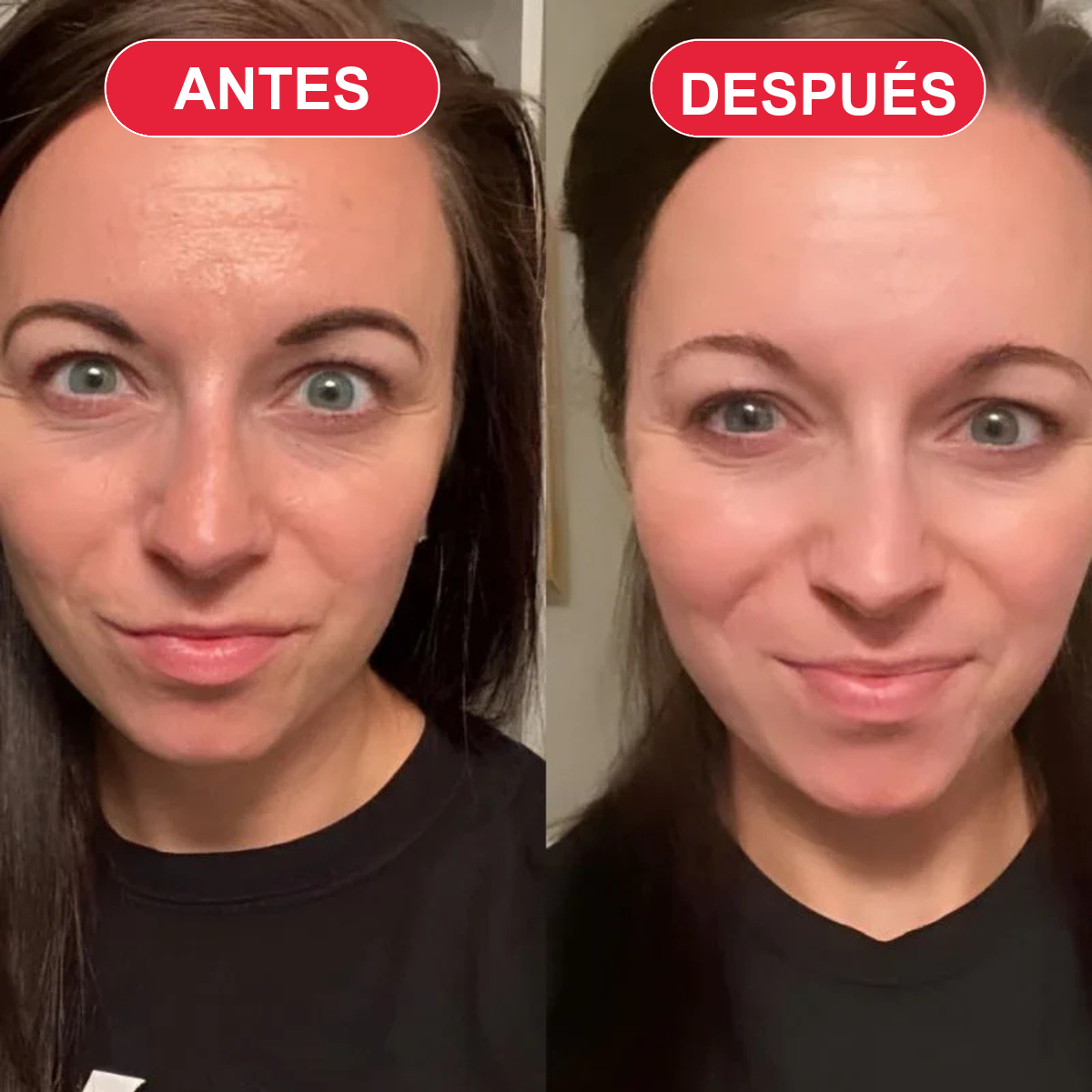 Antes y después
