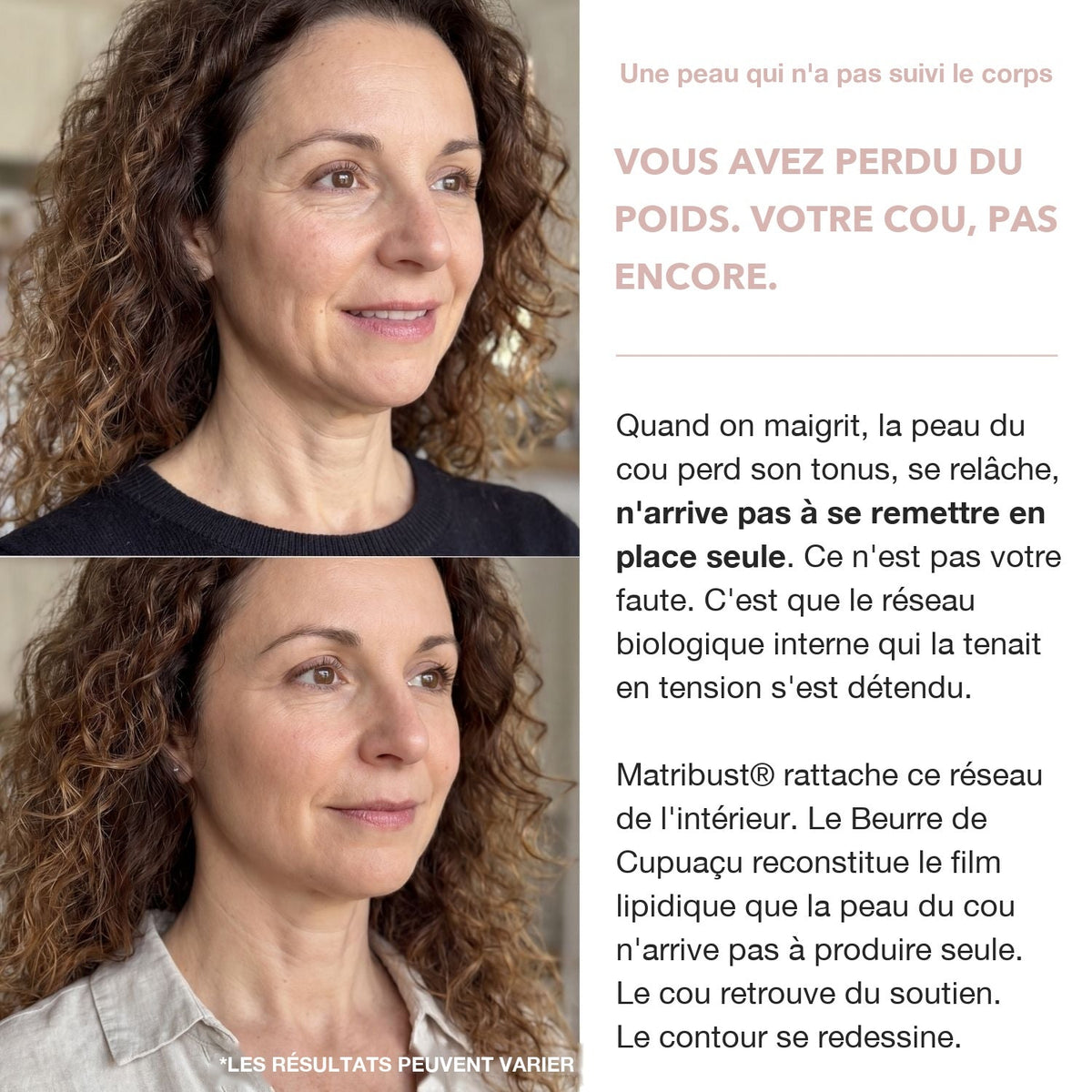 Crème Cou Liftante & Raffermissante BioChroma