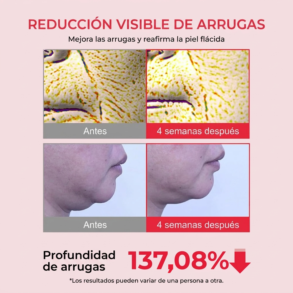 Reducción visible de arrugas
