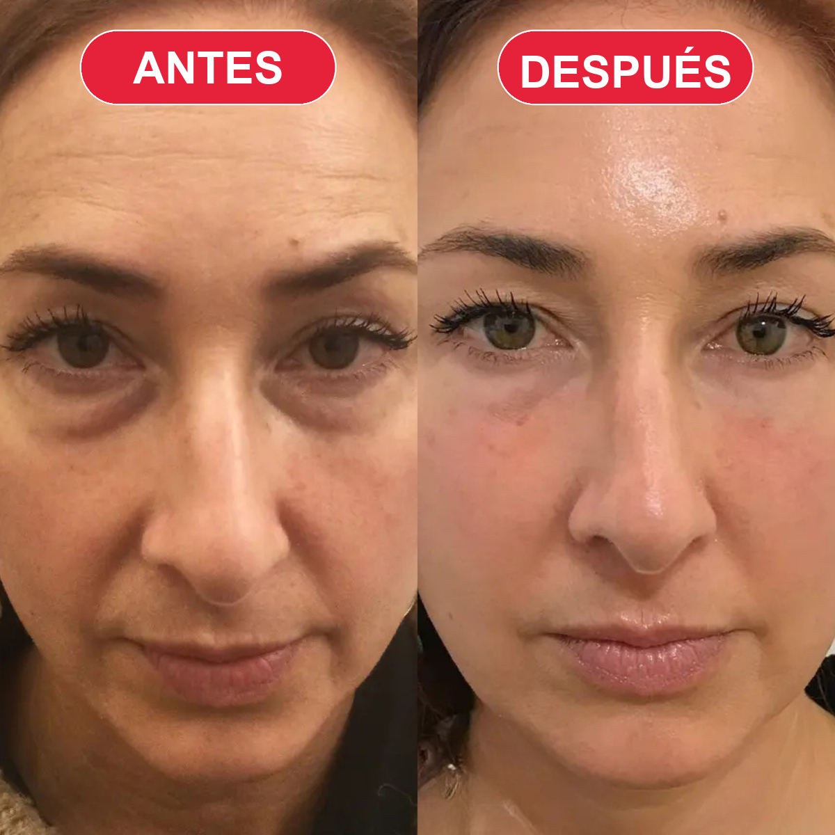 Antes y después